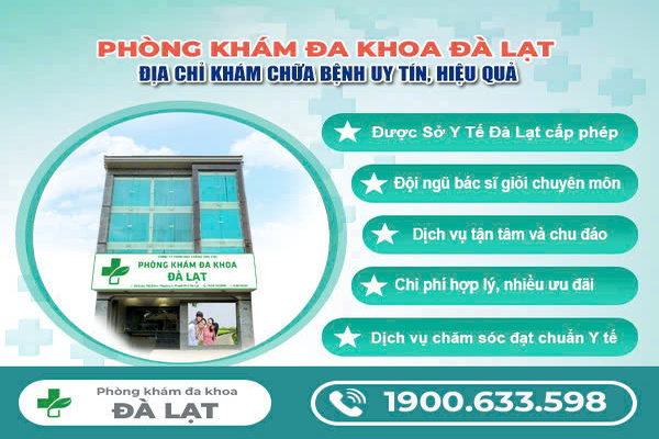 Hình ảnh minh họa